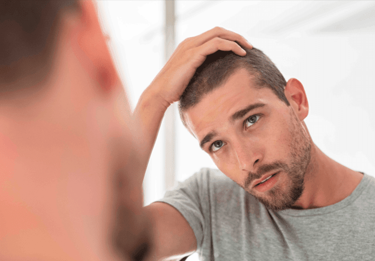 Hair Transplant for HIV Positive Patients